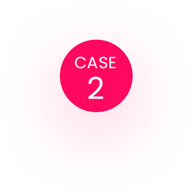 CASE 2