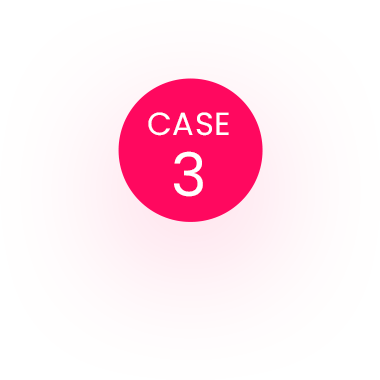 CASE 3